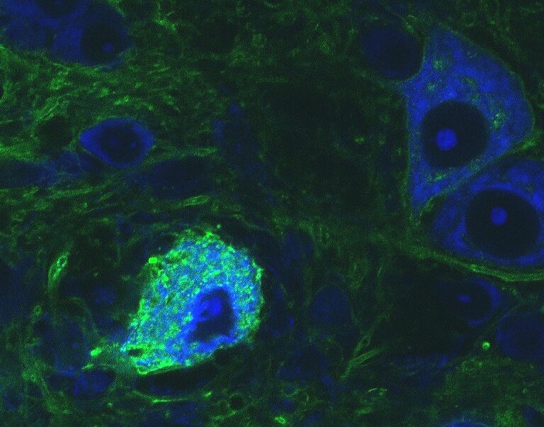 Neuron closeup green and blue