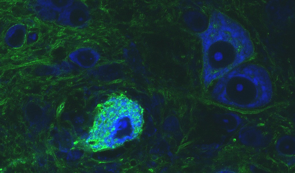 Neuron closeup green and blue