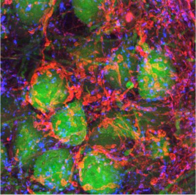 Optogenetics closeup green and pink